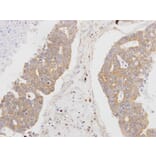 Immunohistochemistry - MSTO1 antibody from Signalway Antibody (22173) - Antibodies.com