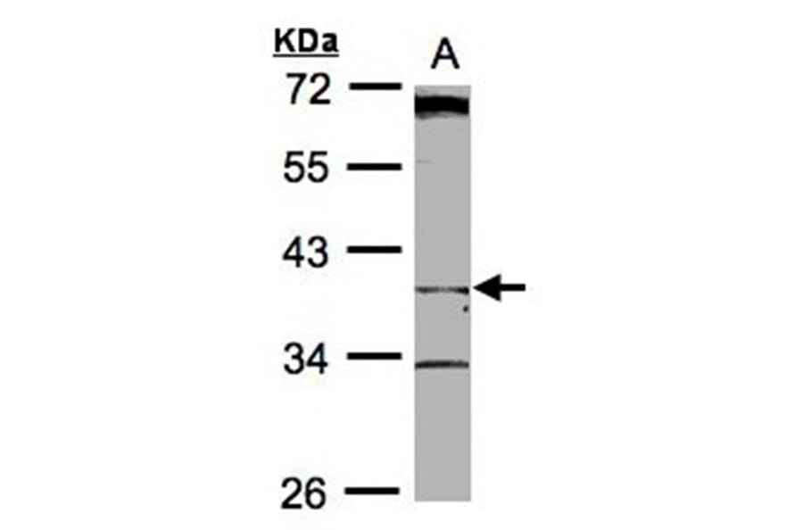 BHMT2 antibody from Signalway Antibody (22183) - Antibodies.com