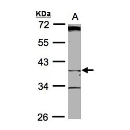 BHMT2 antibody from Signalway Antibody (22183) - Antibodies.com