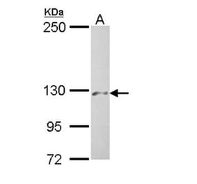 PHKA2 antibody from Signalway Antibody (22226) - Antibodies.com