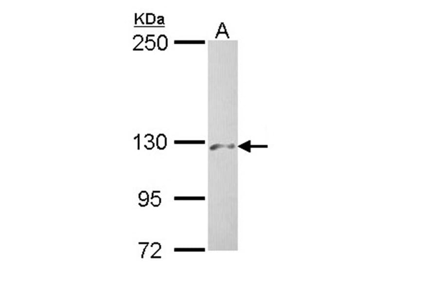 PHKA2 antibody from Signalway Antibody (22226) - Antibodies.com