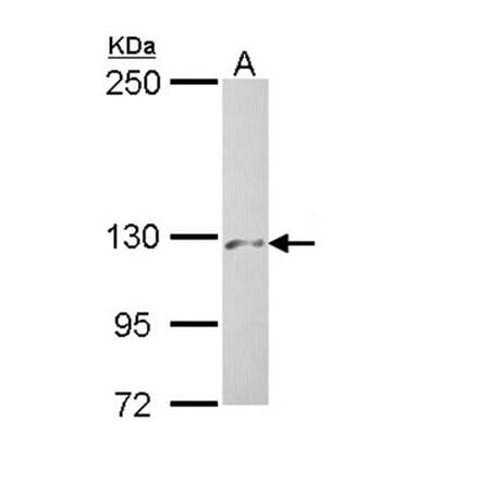 PHKA2 antibody from Signalway Antibody (22226) - Antibodies.com