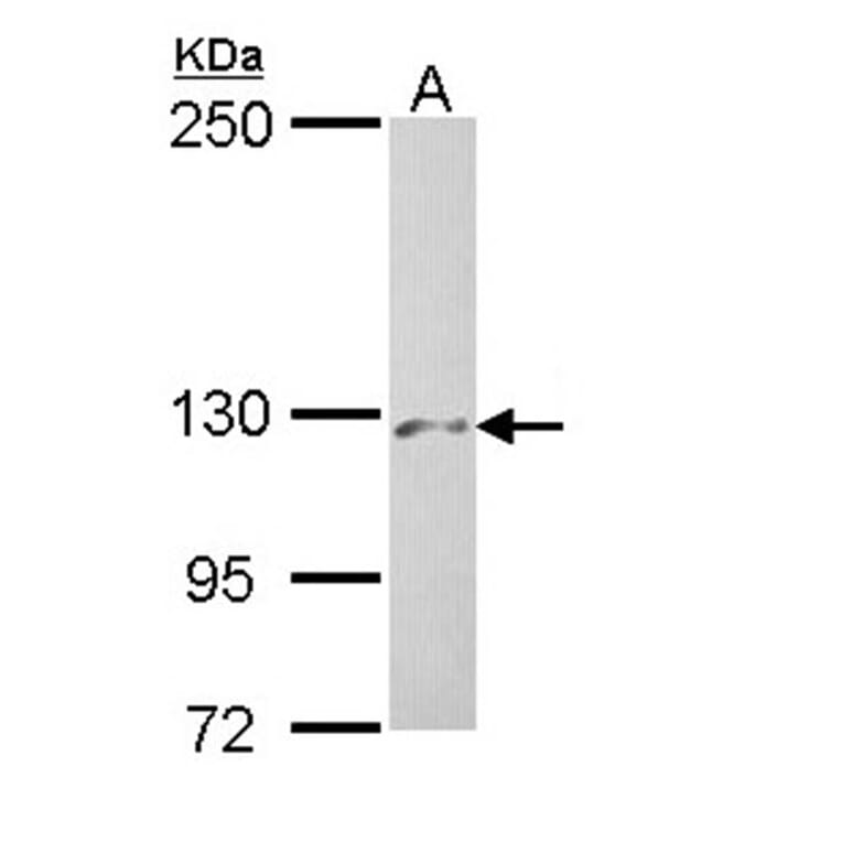 PHKA2 antibody from Signalway Antibody (22226) - Antibodies.com