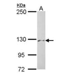 PHKA2 antibody from Signalway Antibody (22226) - Antibodies.com