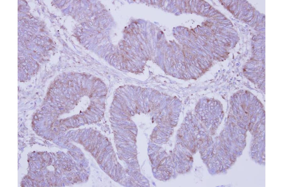 Immunohistochemistry - PHKA2 antibody from Signalway Antibody (22226) - Antibodies.com