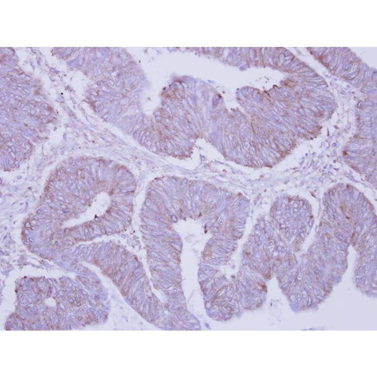 Immunohistochemistry - PHKA2 antibody from Signalway Antibody (22226) - Antibodies.com
