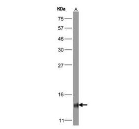 COX5B antibody from Signalway Antibody (22323) - Antibodies.com