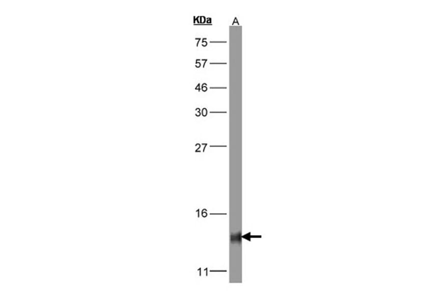 COX5B antibody from Signalway Antibody (22323) - Antibodies.com