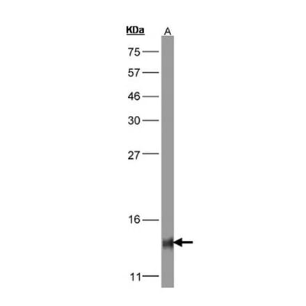 COX5B antibody from Signalway Antibody (22323) - Antibodies.com