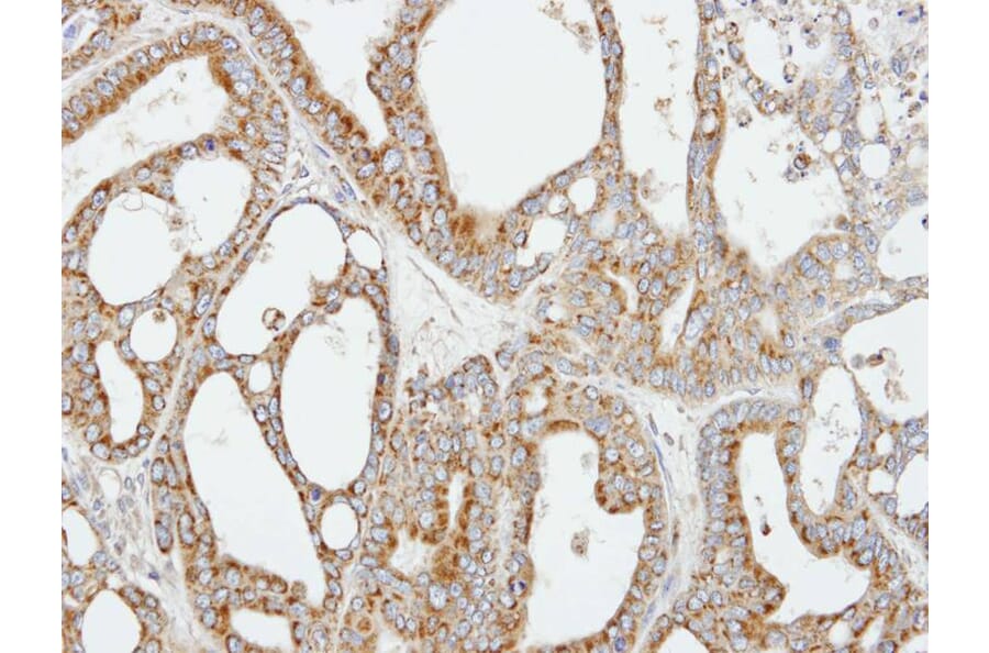 Immunohistochemistry - COX5B antibody from Signalway Antibody (22323) - Antibodies.com