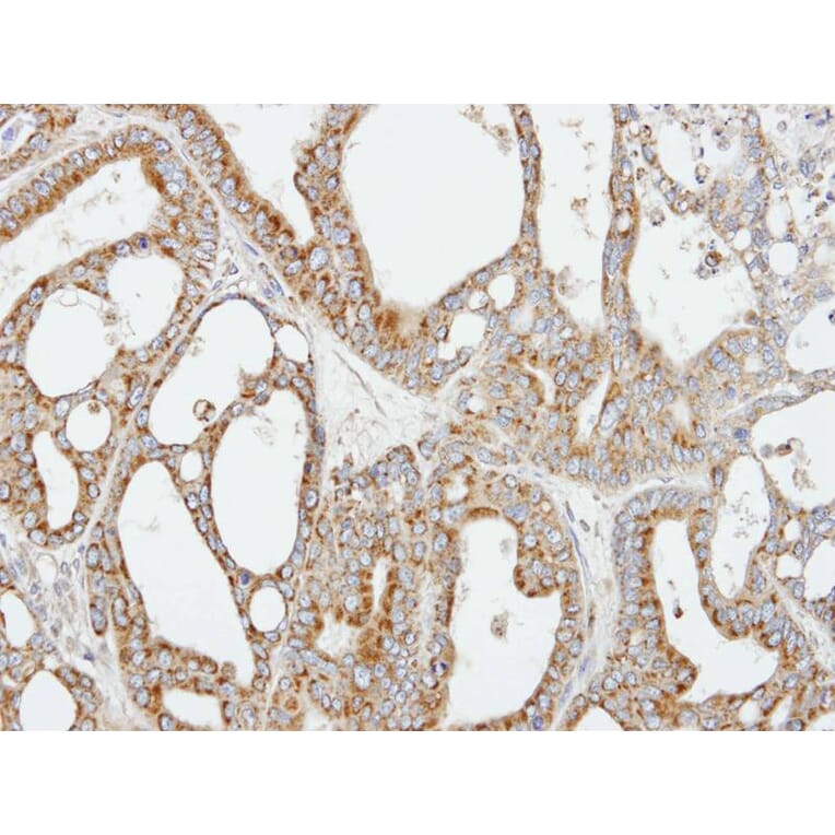 Immunohistochemistry - COX5B antibody from Signalway Antibody (22323) - Antibodies.com