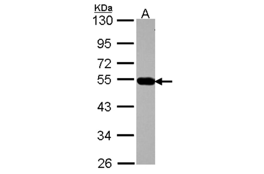 AP4M1 antibody from Signalway Antibody (22335) - Antibodies.com