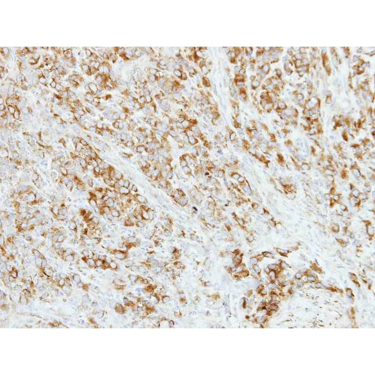 Immunohistochemistry - AP4M1 antibody from Signalway Antibody (22335) - Antibodies.com