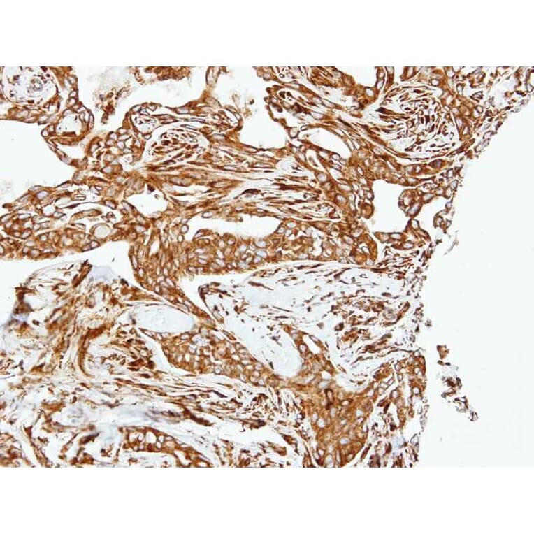 Immunohistochemistry - LOXL2 antibody from Signalway Antibody (22347) - Antibodies.com