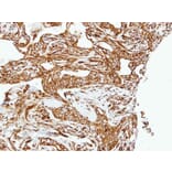 Immunohistochemistry - LOXL2 antibody from Signalway Antibody (22347) - Antibodies.com