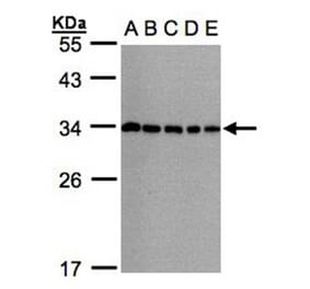 CHMP5 antibody from Signalway Antibody (22389) - Antibodies.com