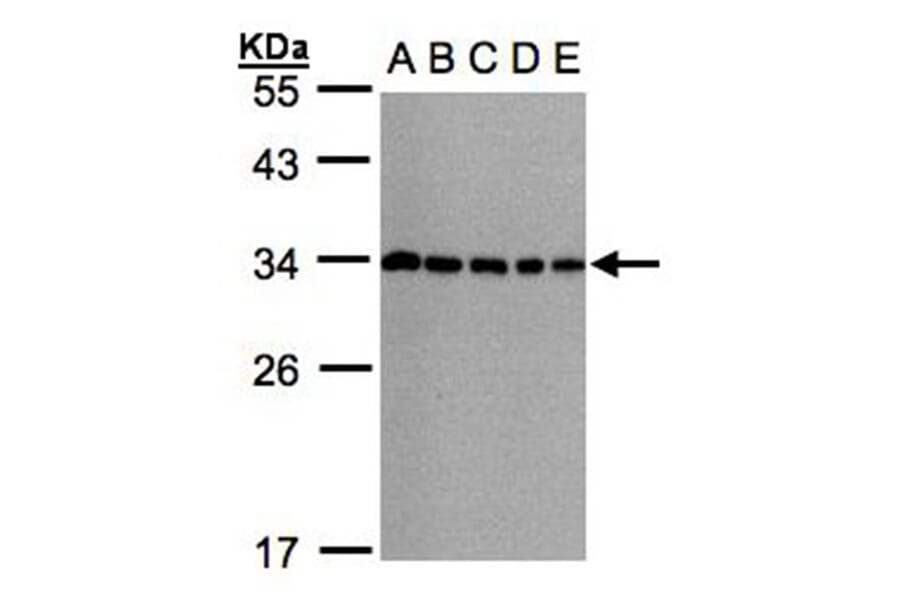 CHMP5 antibody from Signalway Antibody (22389) - Antibodies.com