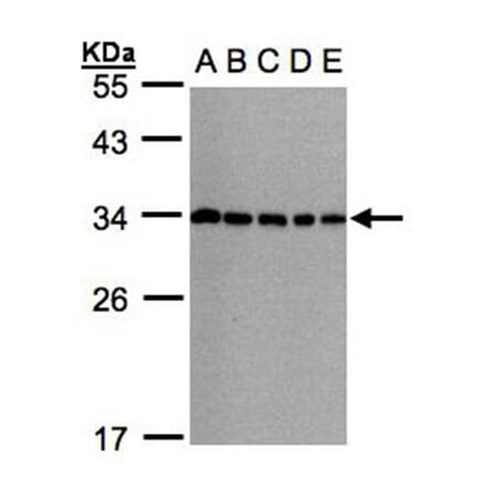 CHMP5 antibody from Signalway Antibody (22389) - Antibodies.com