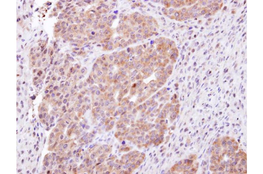 Immunohistochemistry - CHMP5 antibody from Signalway Antibody (22389) - Antibodies.com