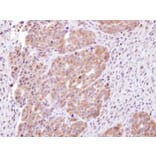 Immunohistochemistry - CHMP5 antibody from Signalway Antibody (22389) - Antibodies.com