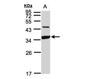 ICAM2 antibody from Signalway Antibody (22396) - Antibodies.com