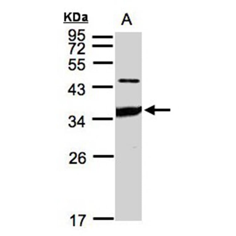 ICAM2 antibody from Signalway Antibody (22396) - Antibodies.com