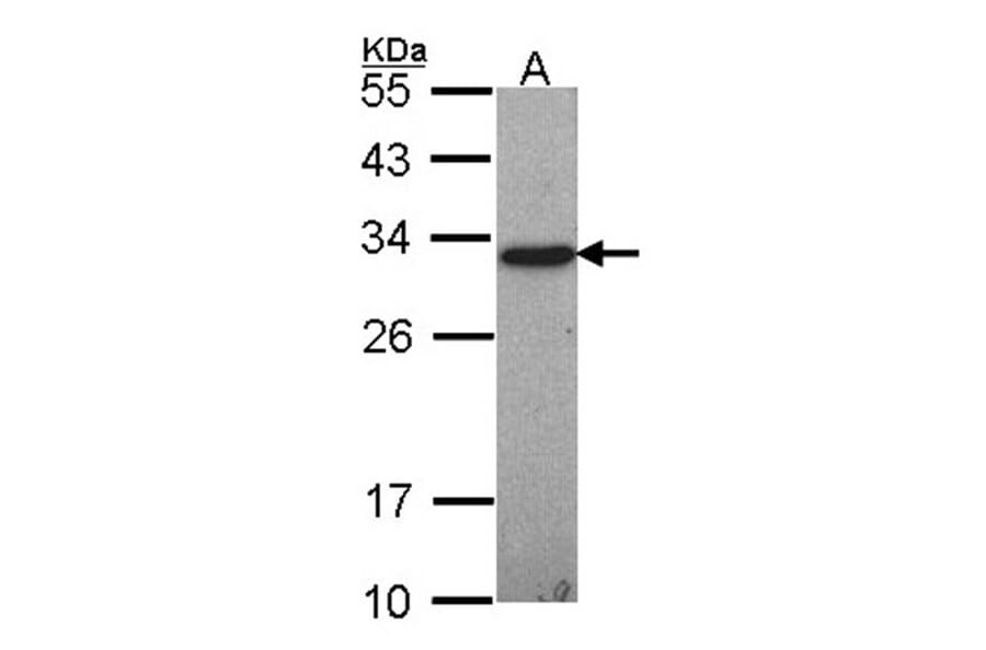 GSTO1 antibody from Signalway Antibody (22403) - Antibodies.com