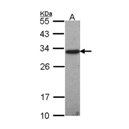 GSTO1 antibody from Signalway Antibody (22403) - Antibodies.com