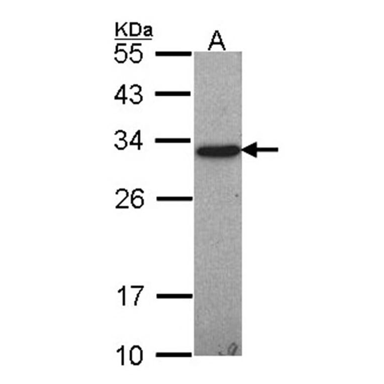 GSTO1 antibody from Signalway Antibody (22403) - Antibodies.com