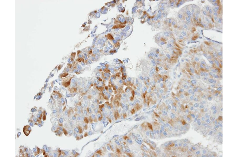 Immunohistochemistry - GSTO1 antibody from Signalway Antibody (22403) - Antibodies.com