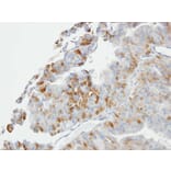 Immunohistochemistry - GSTO1 antibody from Signalway Antibody (22403) - Antibodies.com