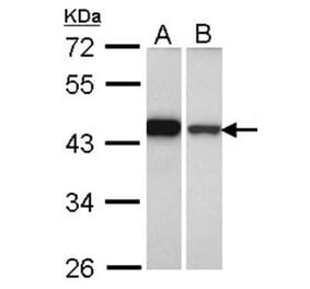 GIPC1 antibody from Signalway Antibody (22473) - Antibodies.com