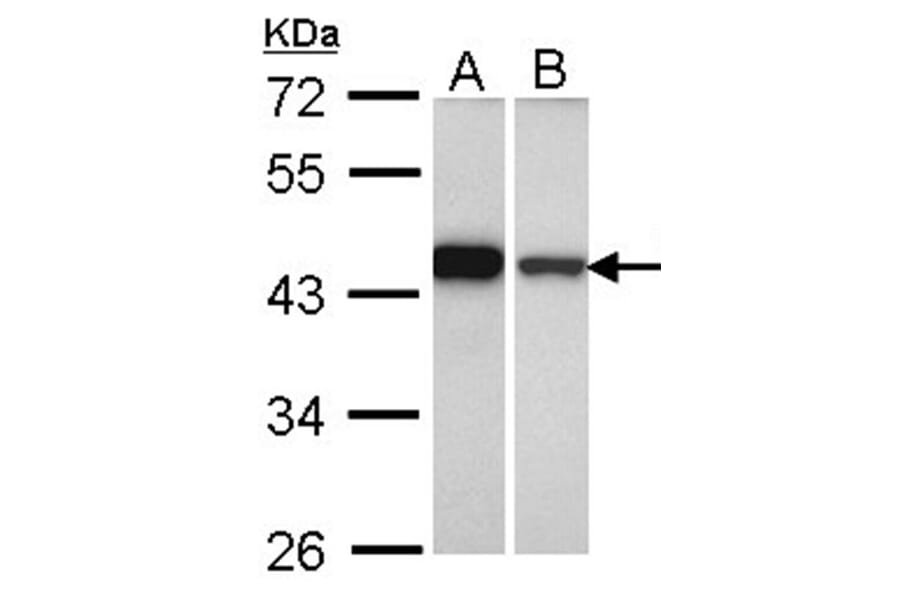 GIPC1 antibody from Signalway Antibody (22473) - Antibodies.com