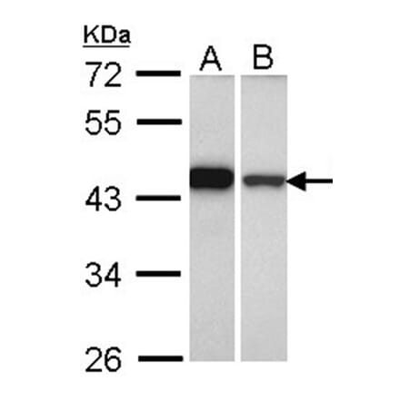 GIPC1 antibody from Signalway Antibody (22473) - Antibodies.com