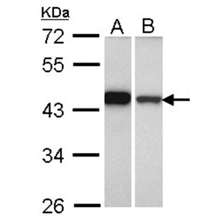 GIPC1 antibody from Signalway Antibody (22473) - Antibodies.com