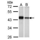 GIPC1 antibody from Signalway Antibody (22473) - Antibodies.com