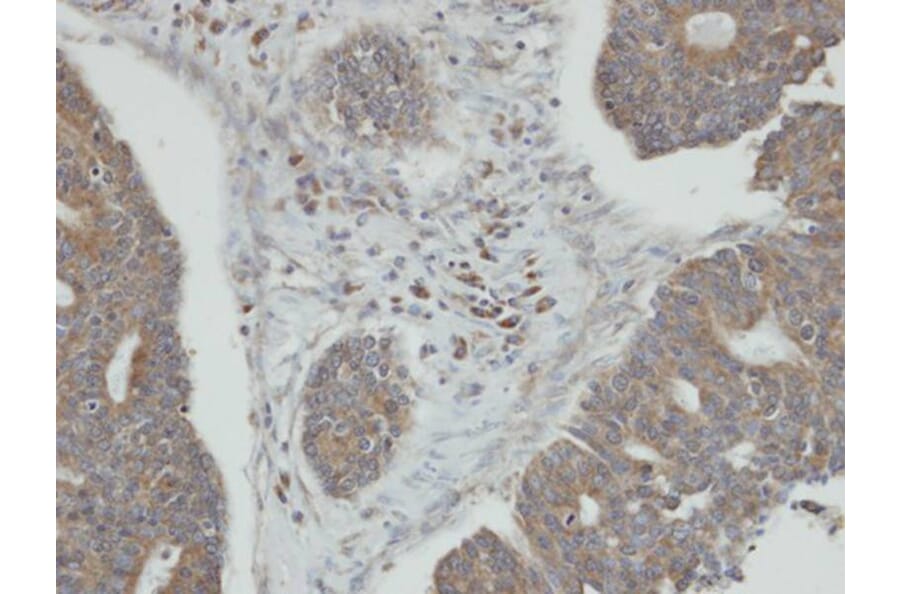 Immunohistochemistry - PPM1K antibody from Signalway Antibody (22478) - Antibodies.com