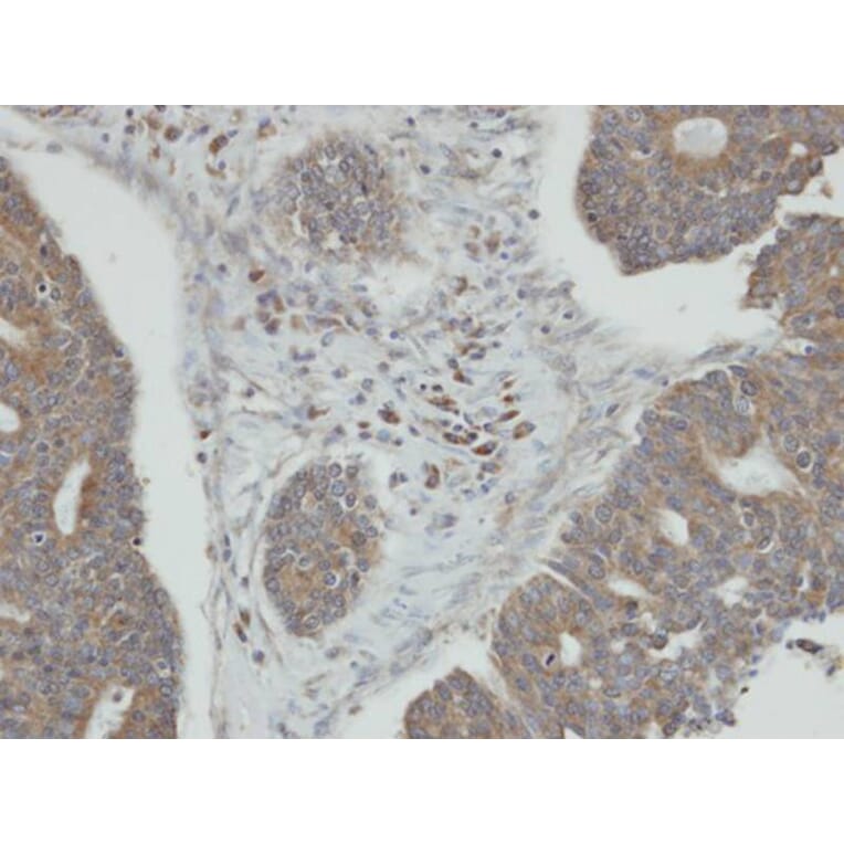 Immunohistochemistry - PPM1K antibody from Signalway Antibody (22478) - Antibodies.com