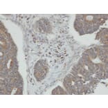 Immunohistochemistry - PPM1K antibody from Signalway Antibody (22478) - Antibodies.com