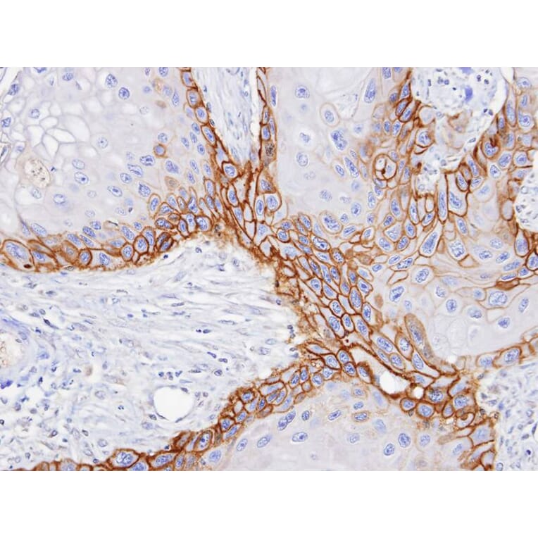 Immunohistochemistry - CD98 antibody from Signalway Antibody (22481) - Antibodies.com