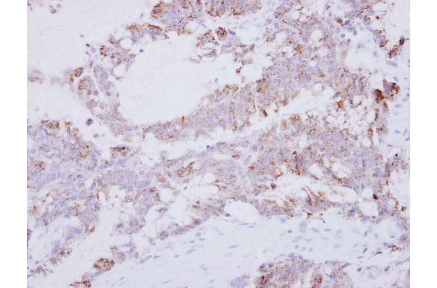 Immunohistochemistry - GRAP2 antibody from Signalway Antibody (22482) - Antibodies.com