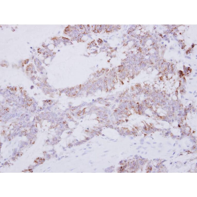 Immunohistochemistry - GRAP2 antibody from Signalway Antibody (22482) - Antibodies.com