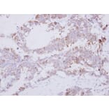 Immunohistochemistry - GRAP2 antibody from Signalway Antibody (22482) - Antibodies.com
