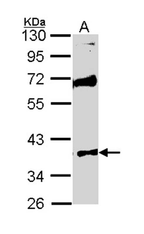 样本(30微g全细胞解析)Raji10%SDSPAGE初级抗体稀释