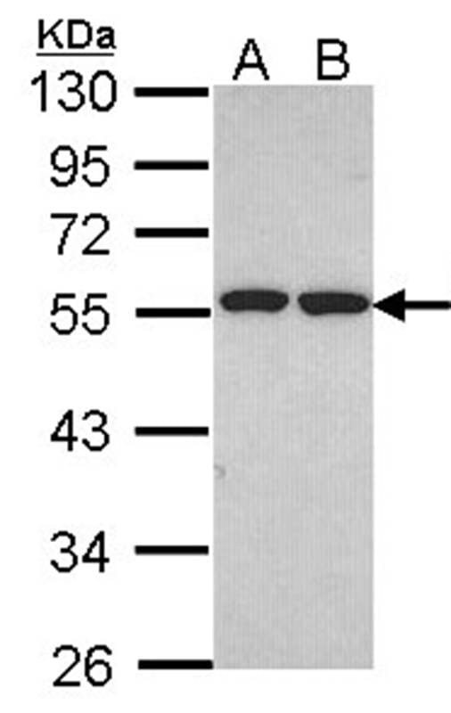 样本(30微g全细胞解析)H1299B:HELA10%SDSPAG初级抗体稀释