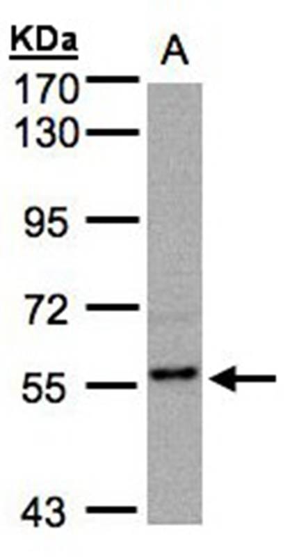 样本(30ug全细胞休眠)MOLT47.5%SDSPAGE初级抗体稀释