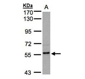 RGS14 antibody from Signalway Antibody (22500) - Antibodies.com