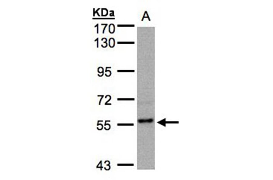RGS14 antibody from Signalway Antibody (22500) - Antibodies.com