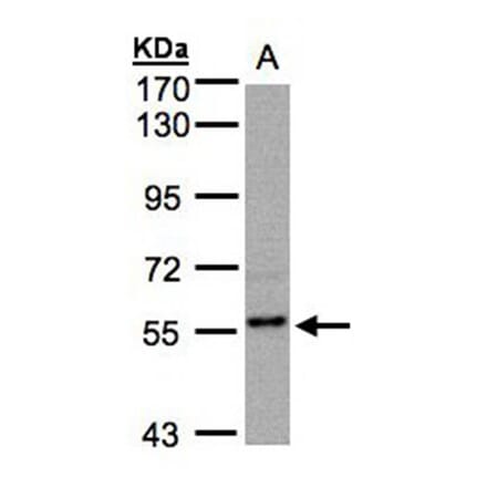 RGS14 antibody from Signalway Antibody (22500) - Antibodies.com