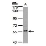 RGS14 antibody from Signalway Antibody (22500) - Antibodies.com